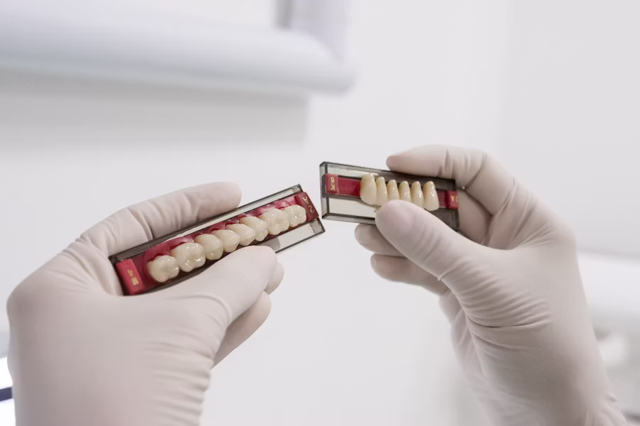 Cura dell'impianto dentale — Studio Dentistico Kustec