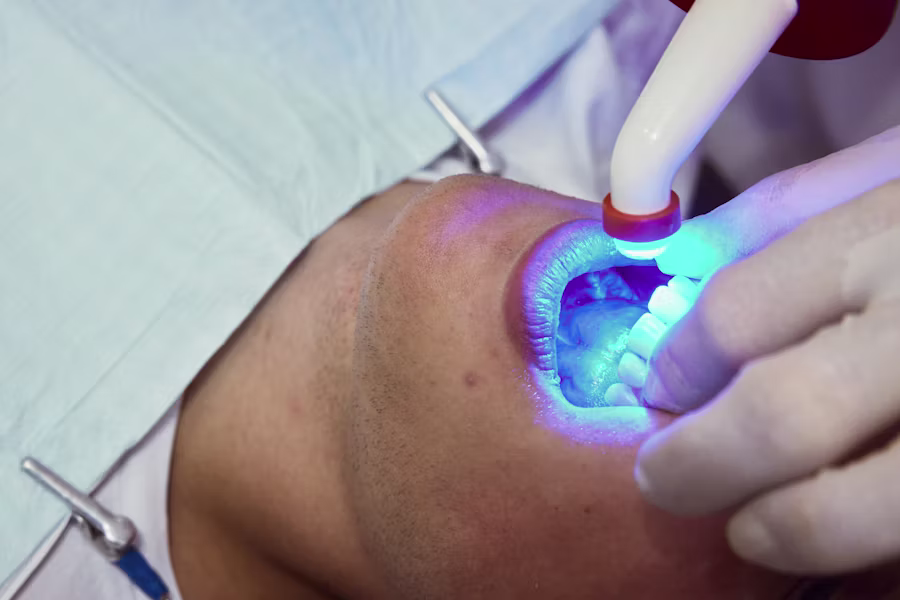 Sbiancamento denti professionale in studio — Studio Dentistico Kustec