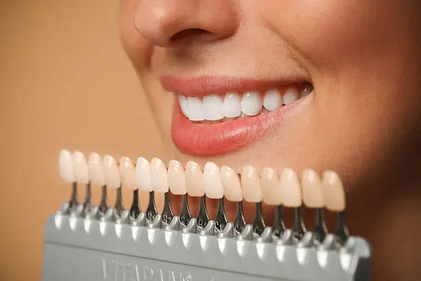 Sorriso perfetto con trattamenti di estetica dentale — Studio Dentistico Kustec